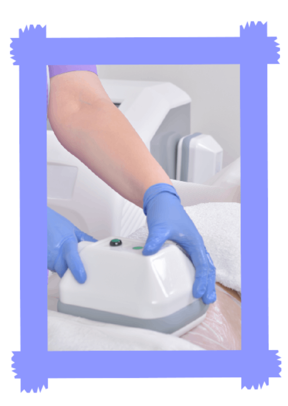 cryolipolyse