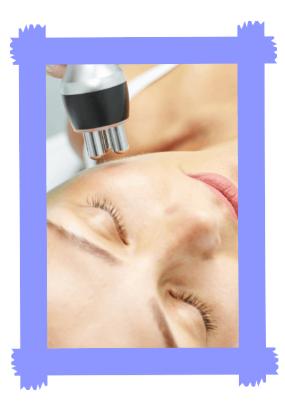 soin de cryopolyse