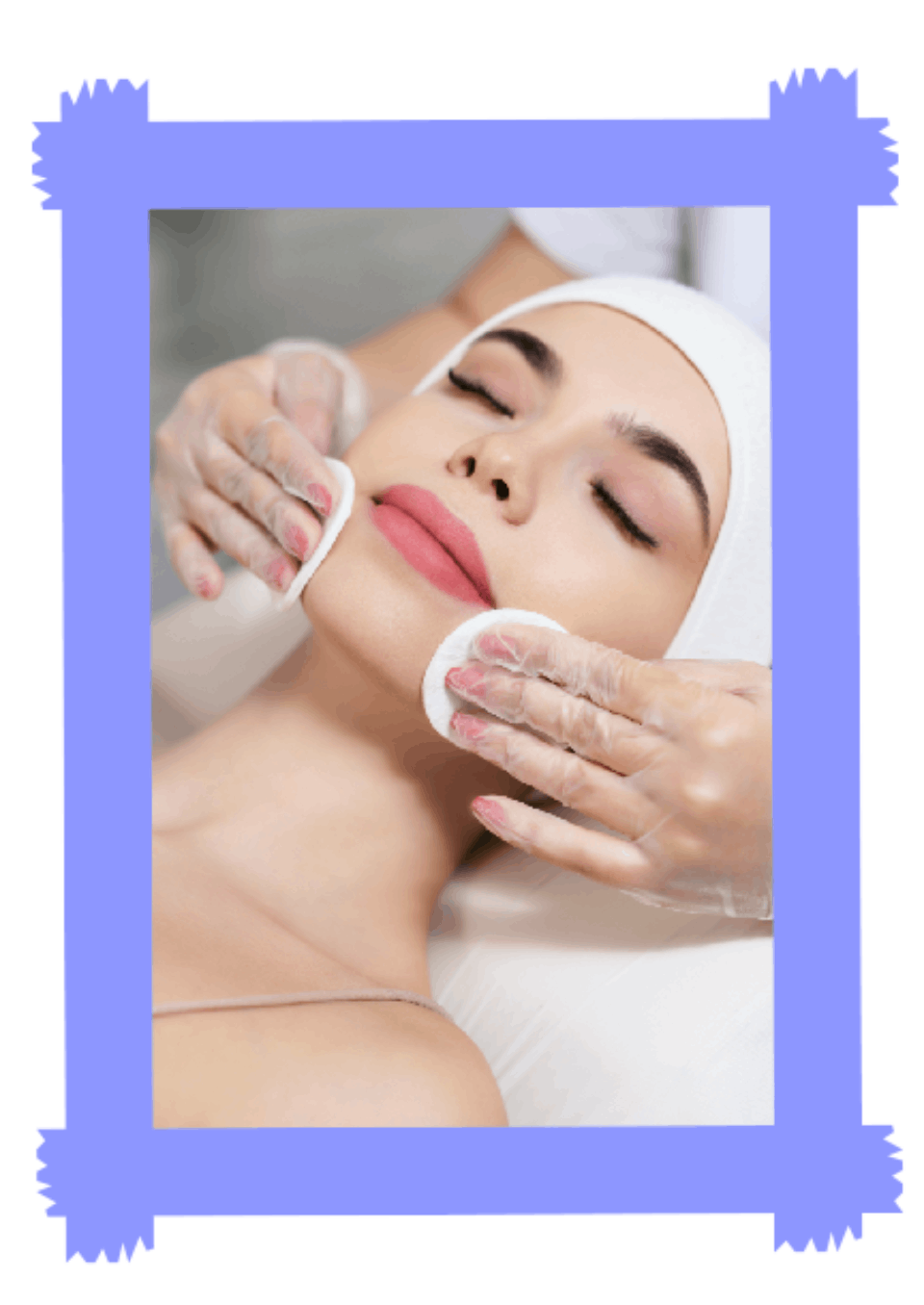 peeling visage